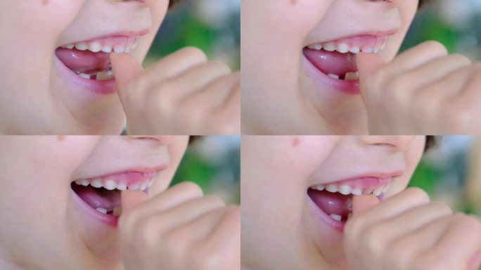 孩子摇了摇乳牙，露出了一个没有牙齿的微笑。在儿童时期把牙齿换成磨牙