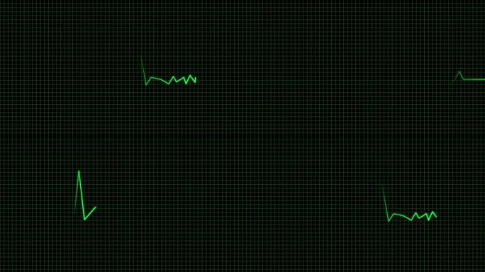 心电图绿带透明通道