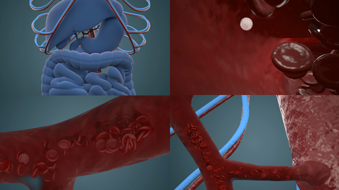 血栓形成 医学动画