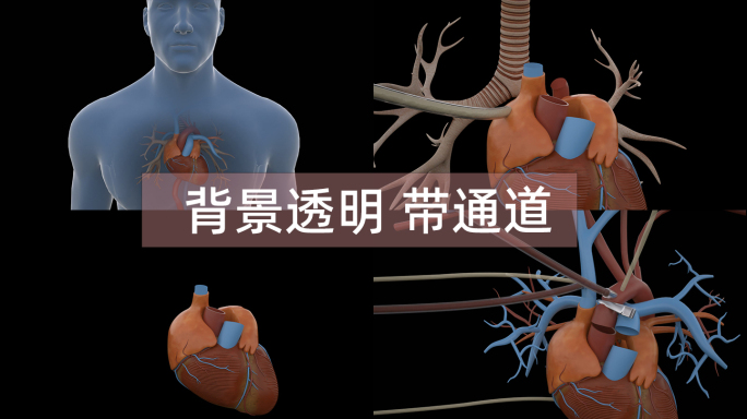 心脏摘除移植手术医学动画 alpha通道