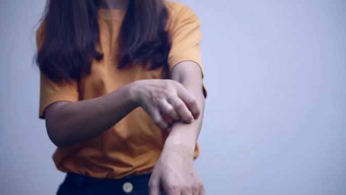 手臂皮肤发痒的亚洲女性。