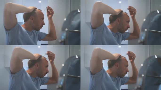 担心脱发和秃顶的男人在家里的浴室里滴下血清或药油产品来刺激头发生长
