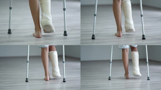 年轻女子拄着拐杖，摔断了一条腿，打了石膏，在家里走路，断腿事故后康复