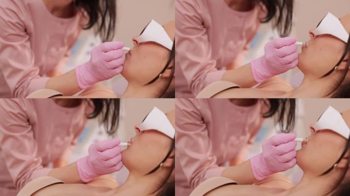 激光脱毛专家会用保护铅笔去除女性脸上的痣。女性戴着手套，用铅笔标出脱毛和保护痣的区域。激光脱毛