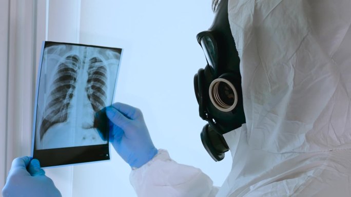 在实验室的x光片上显示肺部的放射性损伤。一名身着化学防护服、戴着防毒面具的工人正在检查辐射损伤。化学