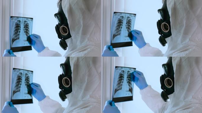 在实验室的x光片上显示肺部的放射性损伤。一名身着化学防护服、戴着防毒面具的工人正在检查辐射损伤。化学