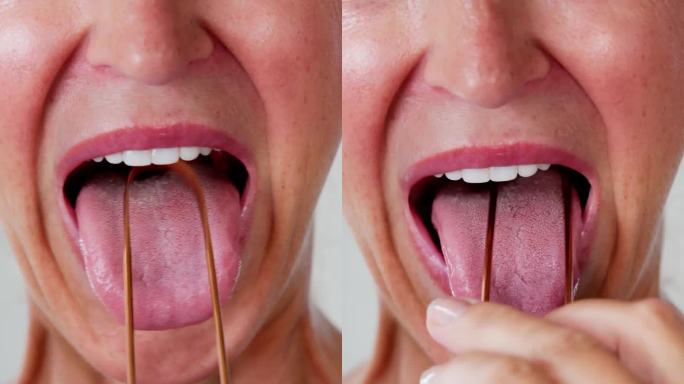 口臭刮舌器刮舌器舌苔