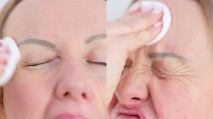 垂直视频一位女士不正确地卸妆，用海绵卸妆液在脸上使劲擦，训练卸妆，用棉絮卸妆，卸妆粉底