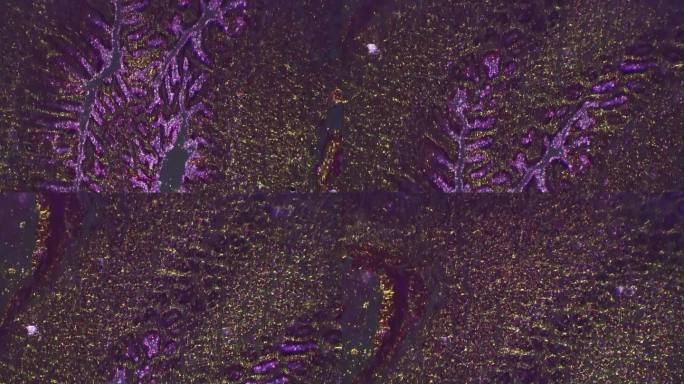 人胃切片在400倍显微镜下倾斜照明下拍摄