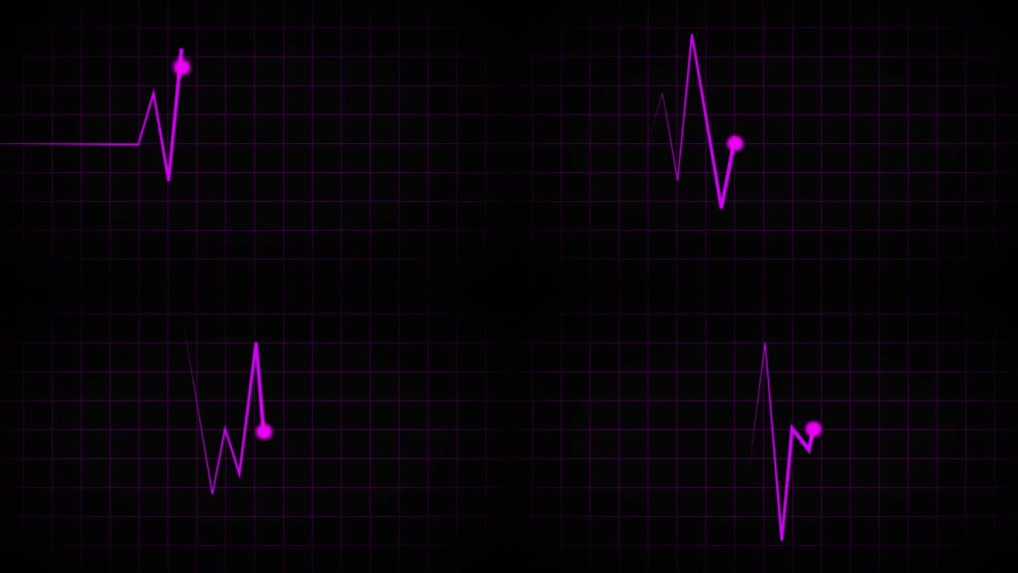 在黑色的屏幕上，霓虹线条描绘了脉搏和心跳。在黑色背景上，是一张心电图。心电图心率监测器。紫色示波器屏