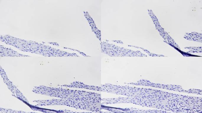 明亮视野下200倍光镜下拍摄的心肌切片