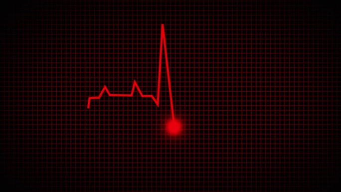 心电监护仪和心跳线一个动画心跳显示。无限循环的4K。心电图和心电图的动画呈现。