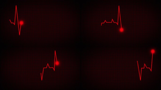 心电监护仪和心跳线一个动画心跳显示。无限循环的4K。心电图和心电图的动画呈现。