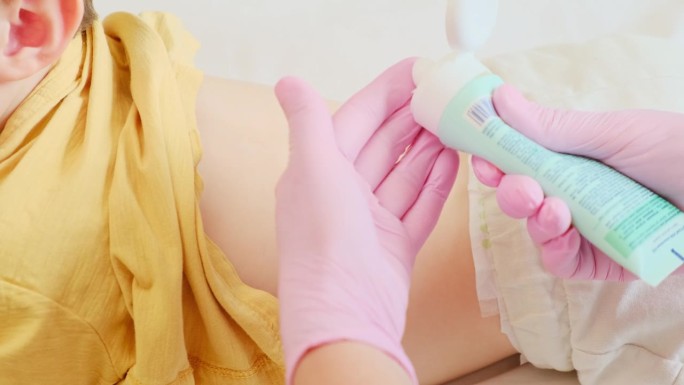 医疗专业人员正在给婴儿使用润肤霜来治疗湿疹。2岁左右(1岁11个月)