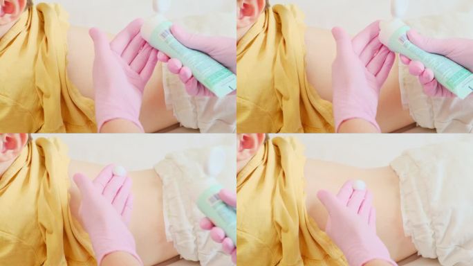 医疗专业人员正在给婴儿使用润肤霜来治疗湿疹。2岁左右(1岁11个月)