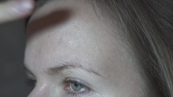 一位女士正在用遮瑕膏遮盖额头上的粉刺。适合油性皮肤的化妆品。