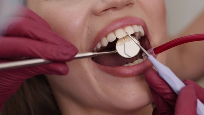牙齿治疗，牙齿聚焦，牙齿健康