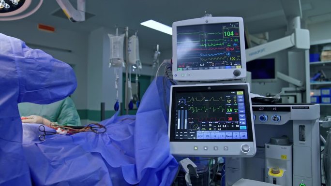 检查手术中病人状况的医疗设备。两个屏幕显示了一个人的生命迹象。一组医生进行神经外科手术。