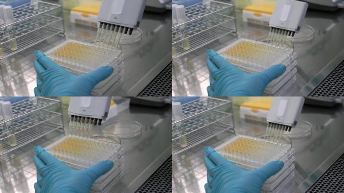 实验室里检查抗生素的培养皿的特写镜头。