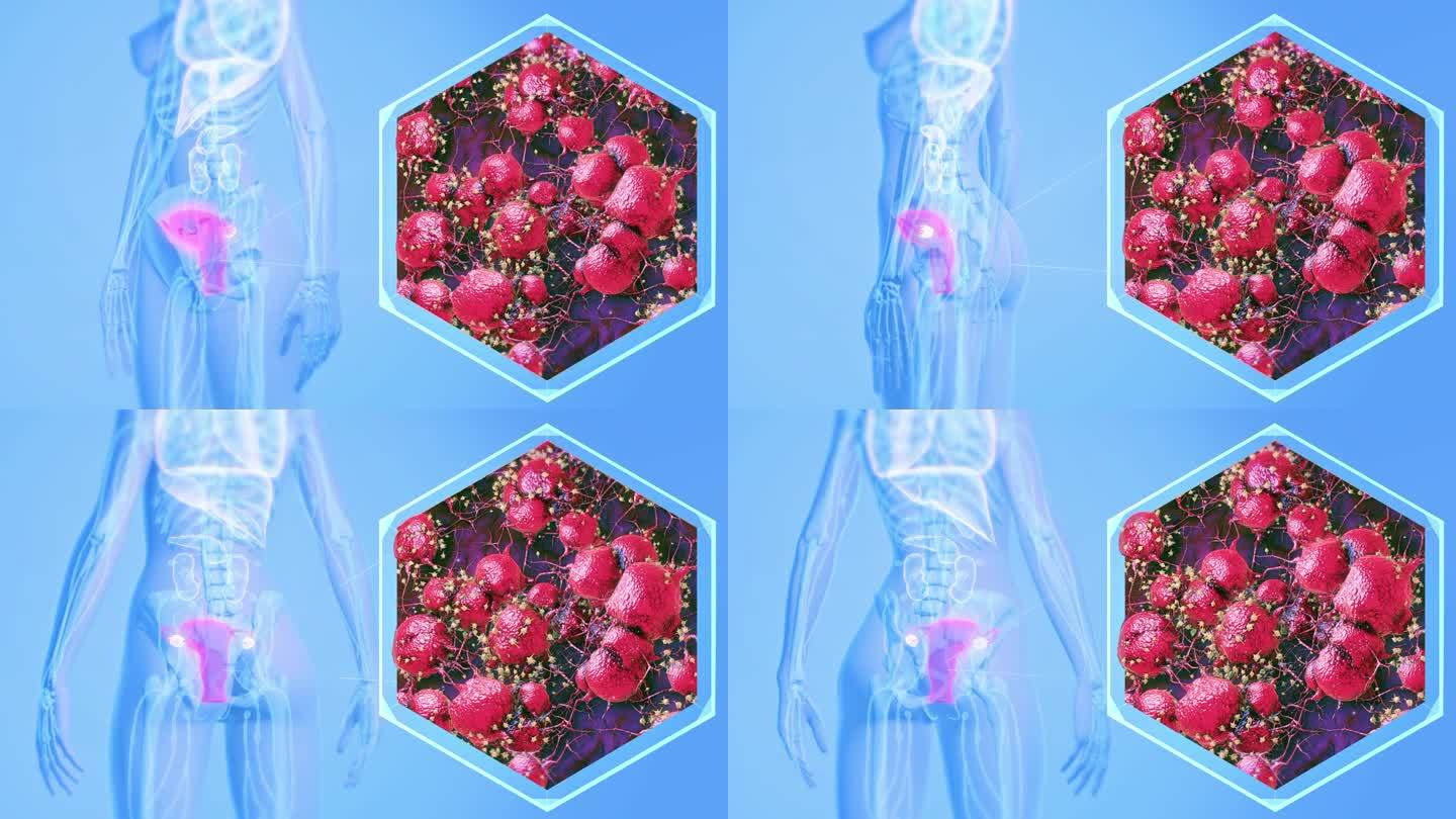 子宫癌医学概念。三维医学器官3D人体