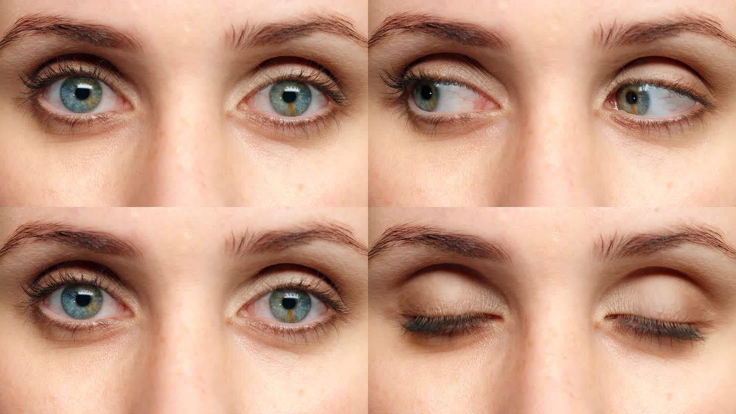 女人，蓝色的眼睛和思考带着焦虑，担心和压力在眨眼的动作。放大肖像，面部和皮肤的模型与压力，偏执和隐形