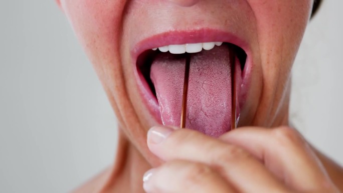 口臭刮舌器外国人口腔护理实拍素材