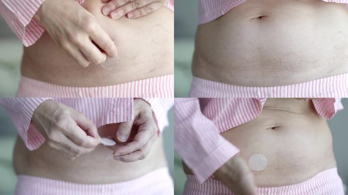 亚洲妇女腹部再次使用激素替代疗法贴片