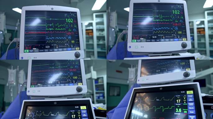 呼吸机屏幕上的曲线和数字在变化。监测手术患者的情况。