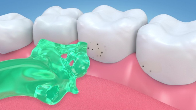 这种绿色的液体可以清洁牙龈和牙齿