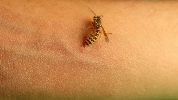 外来兽医的手臂被黄黄蜂蜇伤。
刺痛得很厉害。
值得注意的是，黄蜂能够在不受伤害的情况下收回毒刺。
德