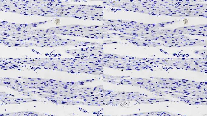 明亮视野下400倍光镜下拍摄的心肌切片