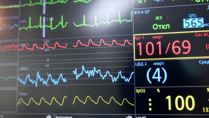 在黑色显示器上显示不同颜色的心率、氧含量和参数曲线。肺呼吸机筛。