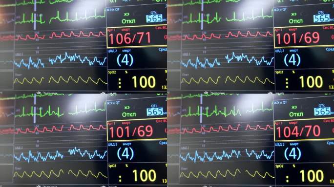 在黑色显示器上显示不同颜色的心率、氧含量和参数曲线。肺呼吸机筛。