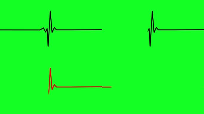 心跳线。脉冲线。心电图心电图。医疗监测。