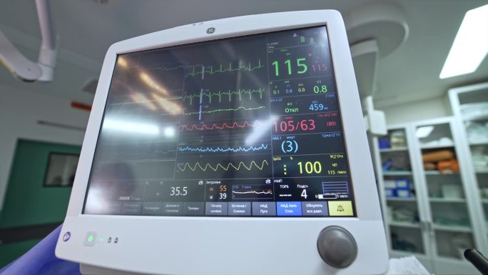 肺呼吸机的屏幕显示手术中患者的生命参数。人工肺呼吸机近距离监测。