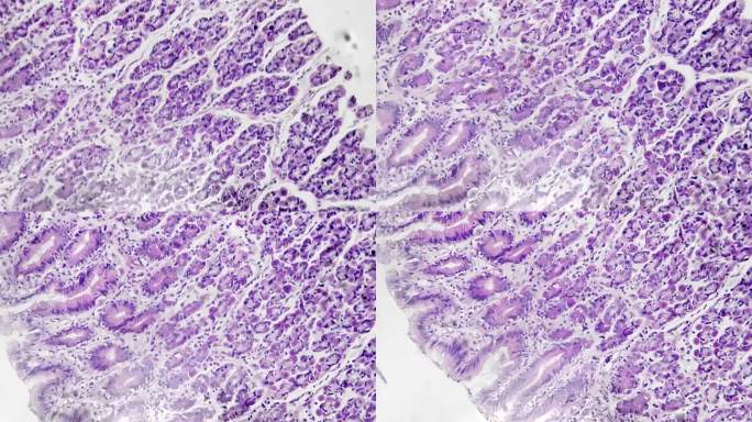 胃底部切片在显微镜下放大200倍