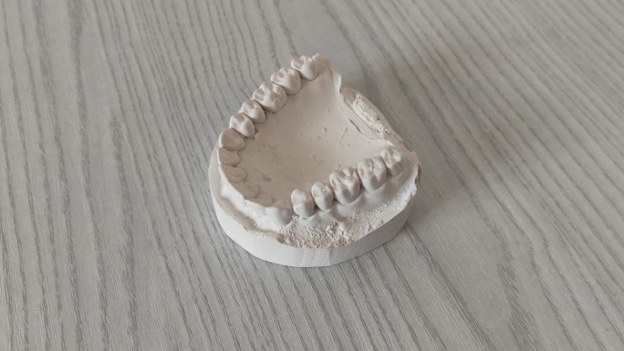 牙医桌上的下巴石膏模型