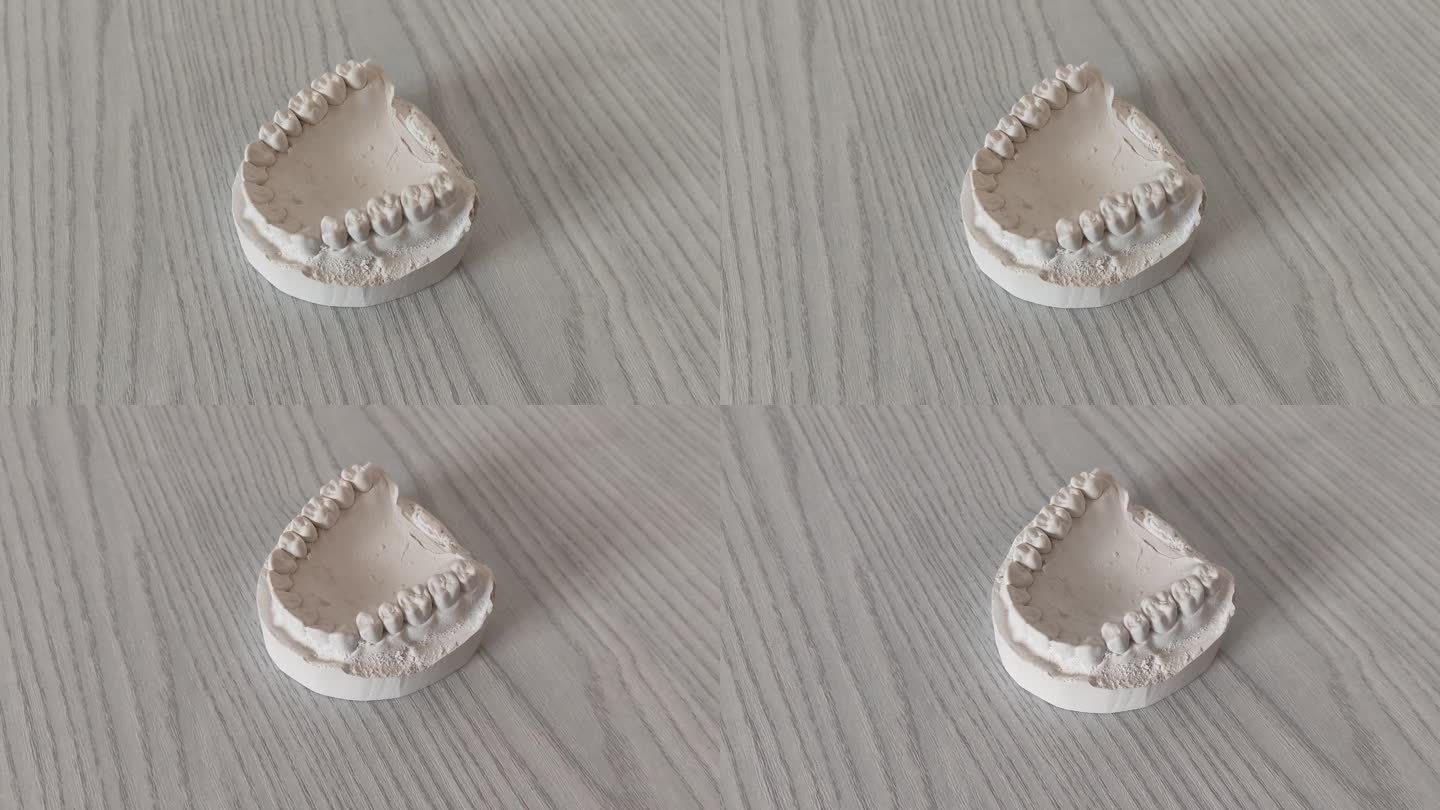 牙医桌上的下巴石膏模型