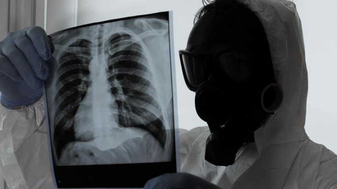 肺部受辐射影响，呼吸道受化学物质影响。一名工人戴着防毒面具，穿着化学工作服。肺结核，疾病分析检查。