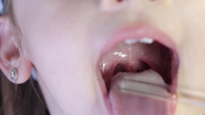 勇敢开朗的女孩向医生张大嘴巴，露出喉咙。