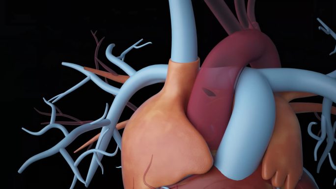 心脏 室间隔缺损 先天性心脏病 手术展示