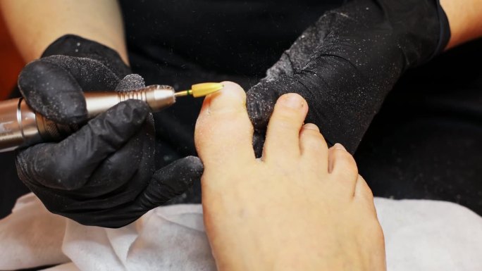 修脚师傅在涂指甲油前用一种特殊的工具打磨甲床，使其表面平整