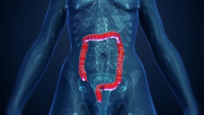女性大肠解剖护理三维肠道