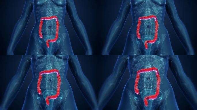 女性大肠解剖护理三维肠道