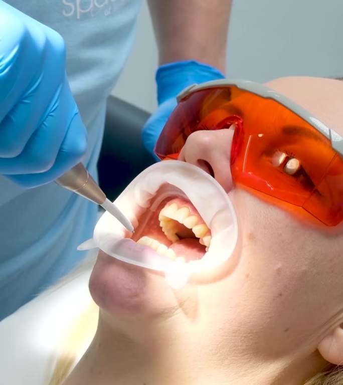 为牙科手术做准备的妇女用喷射水冲洗牙齿橙色的护目镜蓝色的医生和护士干净的手套无菌的清洁光聚合物灯op