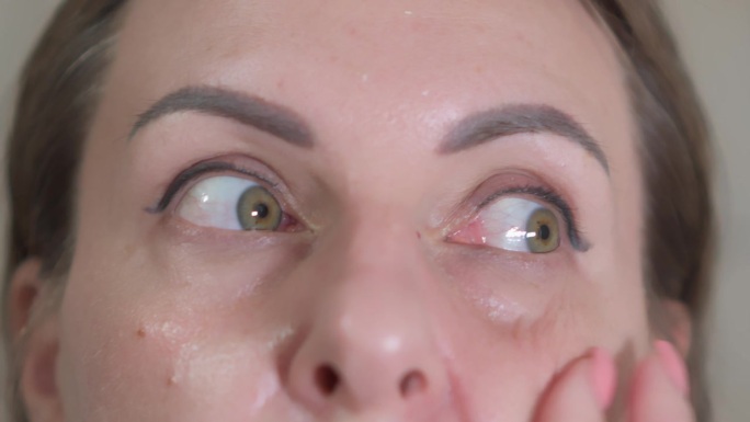 女人在眼睛下面涂眼霜，照顾她的皮肤状况。她在努力去除皱纹。