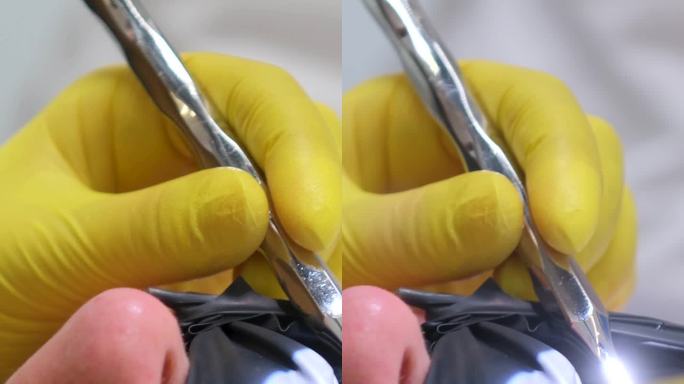 龋齿预防综述。在一次牙科手术中，一位妇女坐在牙医的椅子上，黄色的洗手手套