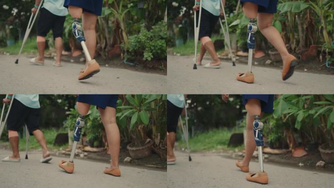 义肢截肢妇女的积极生活方式——拥抱勇气和韧性