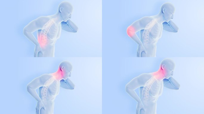 关节颈椎脊柱腰椎肩颈关节疼痛医疗视频素材
