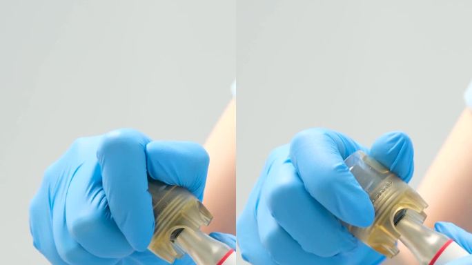 气流装置深层清洁牙垢清洁结石及牙菌斑白底最新装置牙科新发明